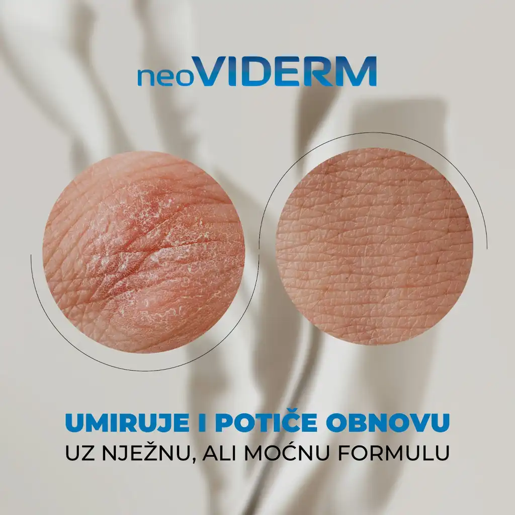 Neoviderm emulzija 100ml - Slika 7