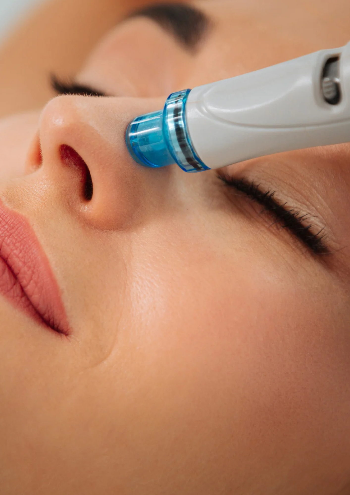 Hydrafacial tretman i njega osjetljive kože