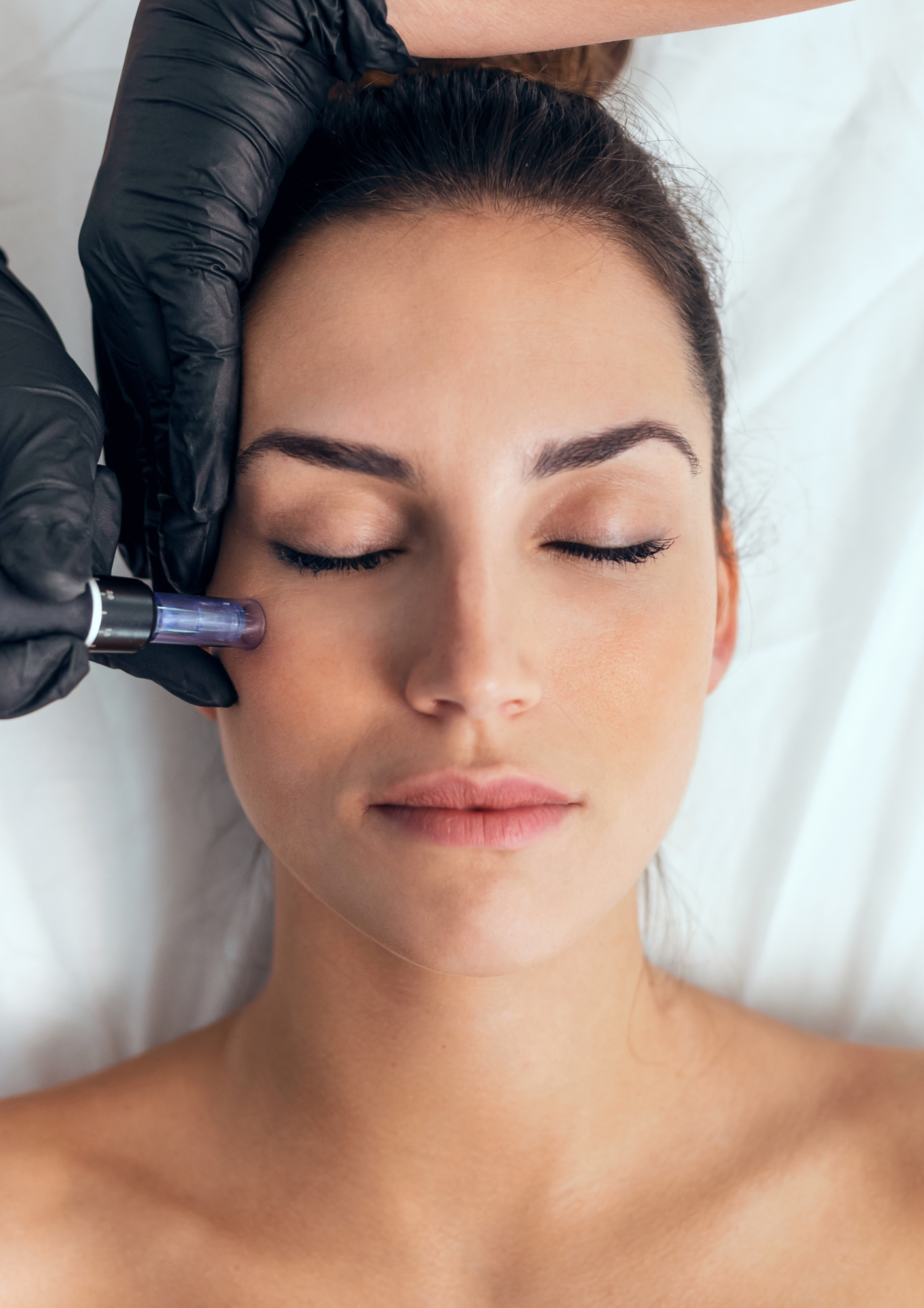 Hydrafacial tretman i njega osjetljive kože